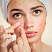 acne causes treatment