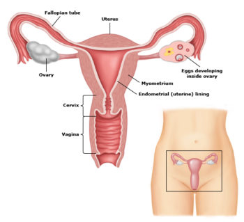 hysterectomy female anatomy 