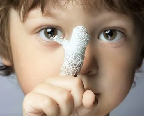 treat minor injury cut scrape