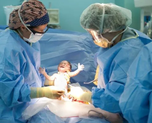 cesarean section