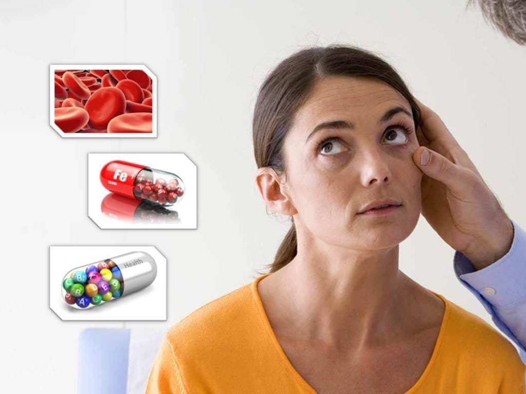 anemia symptoms causes treatment