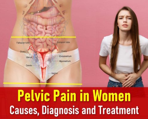 pelvic pain, sudden stabbing pain in pelvic area female, pelvic pain in women, pregnant, where is pelvic pain located