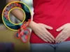 sexually transmitted diseases (STDs)