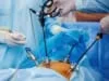 laparoscopic hysterectomy procedure benefits risks recovery