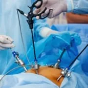 laparoscopic hysterectomy procedure benefits risks recovery