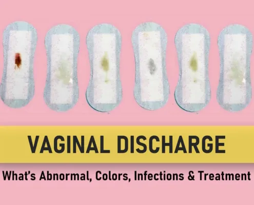 pink vaginal discharge, Vaginal discharge that smells like vinegar, what does vaginal discharge taste like