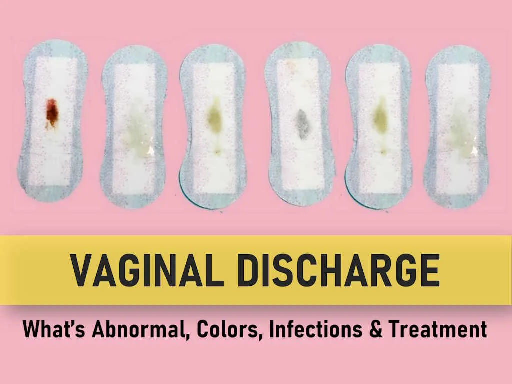 pink vaginal discharge, Vaginal discharge that smells like vinegar, what does vaginal discharge taste like