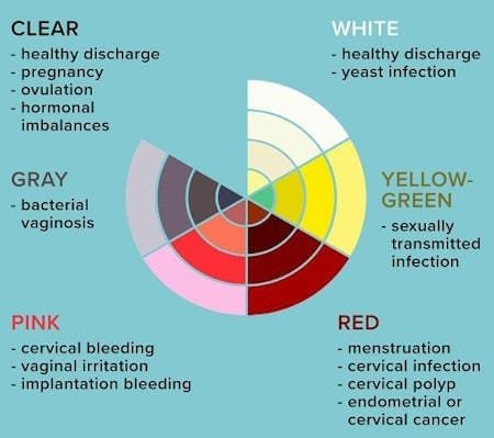 Vaginal Discharge: Causes, Colors, What's Normal & Treatment