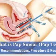 What Is Pap Smear or Pap Test? Age Recommendations, Procedure & Results pap smear test what is a pap smear, abnormal pap smear, pap smear tool
