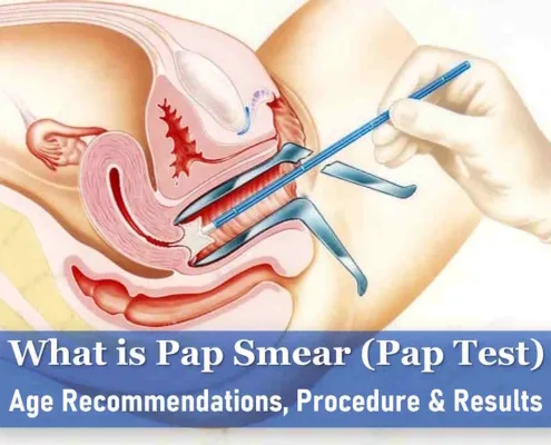 pap smear test what is a pap smear, abnormal pap smear, pap smear tool