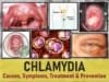 Chlamydia symptoms women men throat bumps chlamydia bumps on tongue, chlamydia bumps on inner thigh,
