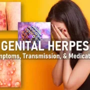 genital herpes symptoms women men, genital herpes treatment medication, genital herpes pictures hsv2