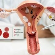 hpv human papillomavirus symptoms treatment hpv human papillomavirus symptoms prevention