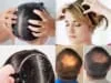 scalp massage hair growth before and after treatment