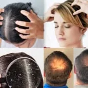 scalp massage hair growth before and after treatment