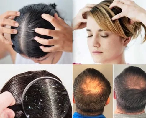 scalp massage hair growth before and after treatment
