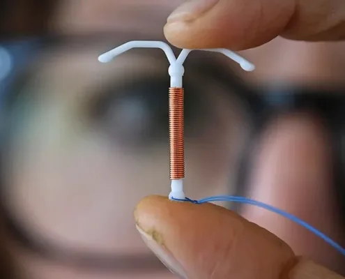 IUD Insertion Pain: Duration, Level, and Management