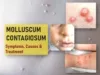 molluscum contagiosum std pictures symptoms treatment