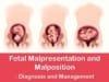 fetal malpresentation and malposition diagnosis and management