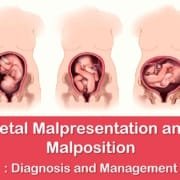 fetal malpresentation and malposition diagnosis and management fetal malpresentation and malposition diagnosis and management