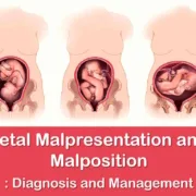 fetal malpresentation and malposition diagnosis and management
