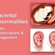 Placenta Previa, Placenta Accreta, Increta, and Percreta, Bilobed and Succenturiate Placenta