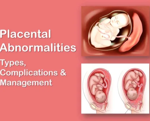 Placenta Previa, Placenta Accreta, Increta, and Percreta, Bilobed and Succenturiate Placenta