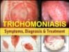 Trichomoniasis Trich Symptoms men women, Causes trichomoniasis Treatment, Medication, trichomoniasis discharge, cervix pictures