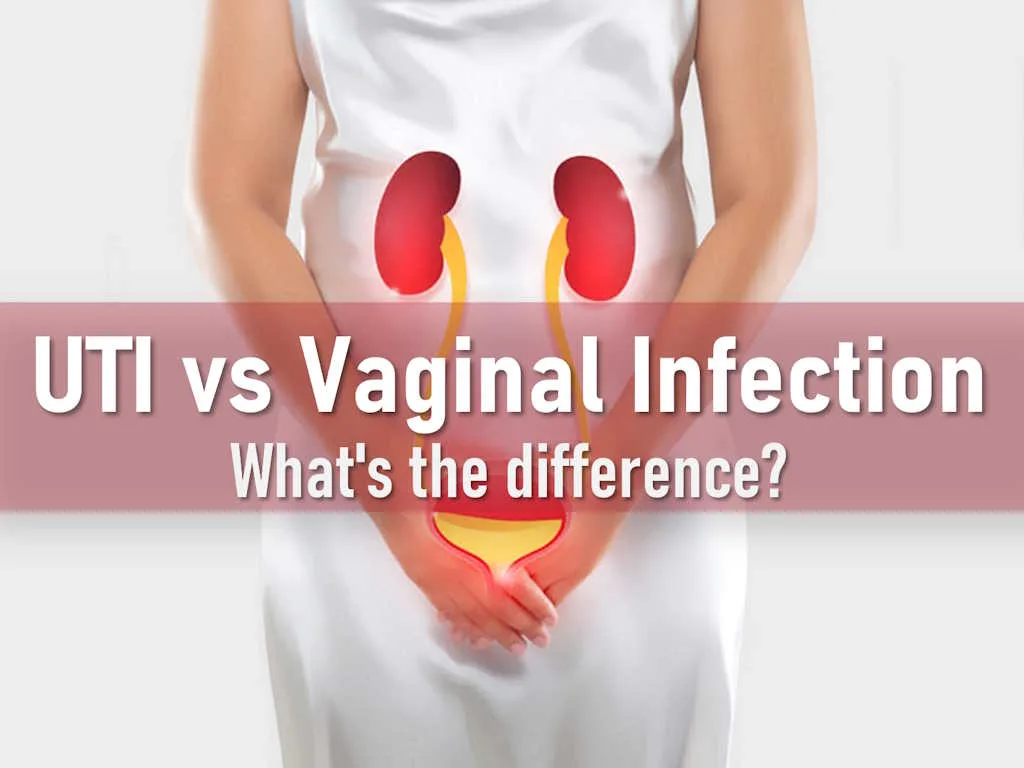 Urinary Tract Infection UTI vs Yeast Infection vs BV Bacterial Vaginosis vs Trichomoniasis symptoms treatment