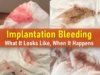 implantation bleeding pictures, when it happens, what it looks like