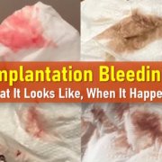 implantation bleeding pictures, when it happens, what it looks like