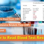 How to Read Blood Test Results, mch blood test, mchc blood test, mcv blood test, rdw blood test, bun How to Read Blood Test Results, mch blood test, mchc blood test, mcv blood test, rdw blood test, bun