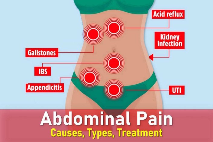 ABDOMINAL PAIN TYPES CAUSES TREATMENT HOME REMEDIES visual data 7