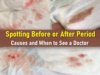 spotting before period, spotting after period, what does spotting look like, spotting vs period