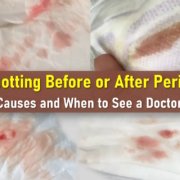 spotting before period, spotting after period, what does spotting look like, spotting vs period