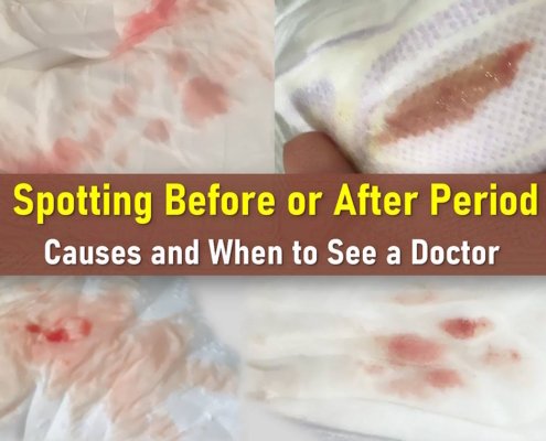 spotting before period, spotting after period, what does spotting look like, spotting vs period