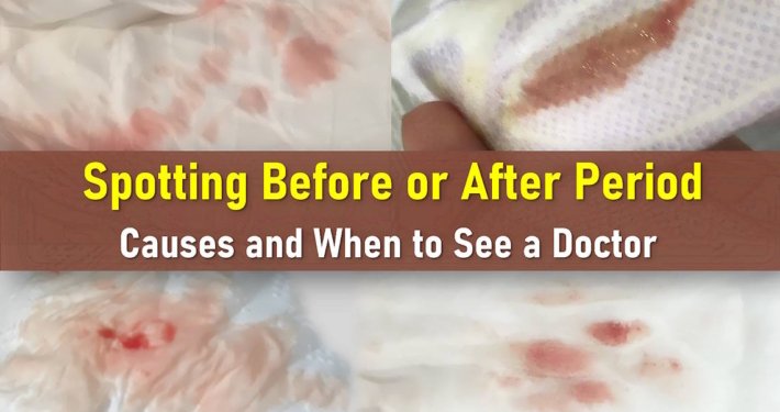 spotting before period, spotting after period, what does spotting look like, spotting vs period