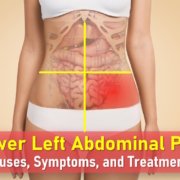 left lower quadrant pain, lower left abdominal pain, llq pain, left side abdominal pain