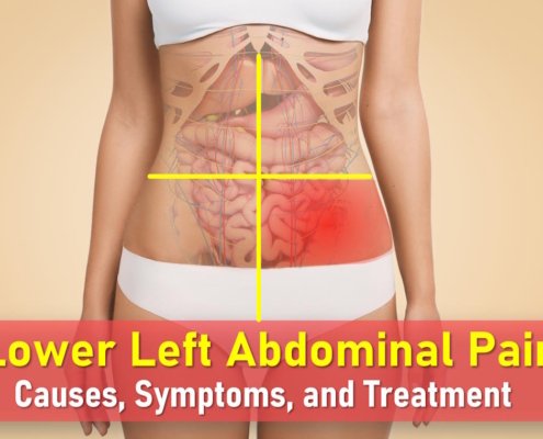 left lower quadrant pain, lower left abdominal pain, llq pain, left side abdominal pain