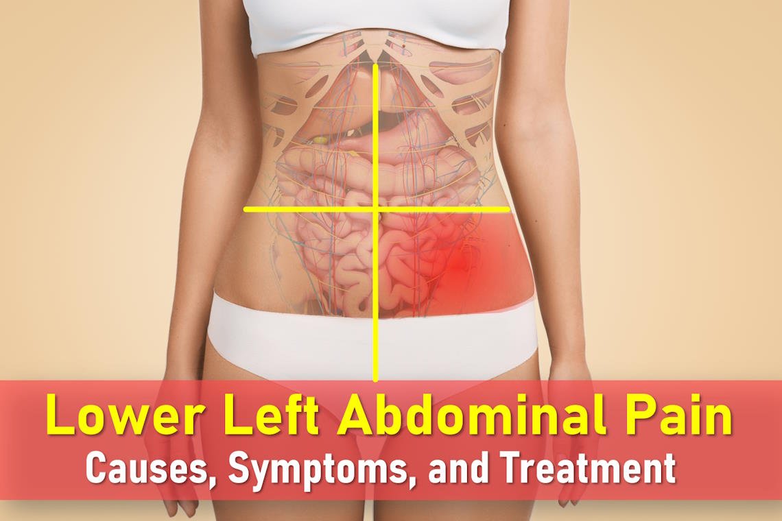 left lower quadrant pain, lower left abdominal pain, llq pain, left side abdominal pain