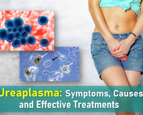 ureaplasma, ureaplasma symptoms, symptoms of ureaplasma in females, ureaplasma infection, ureaplasma treatment