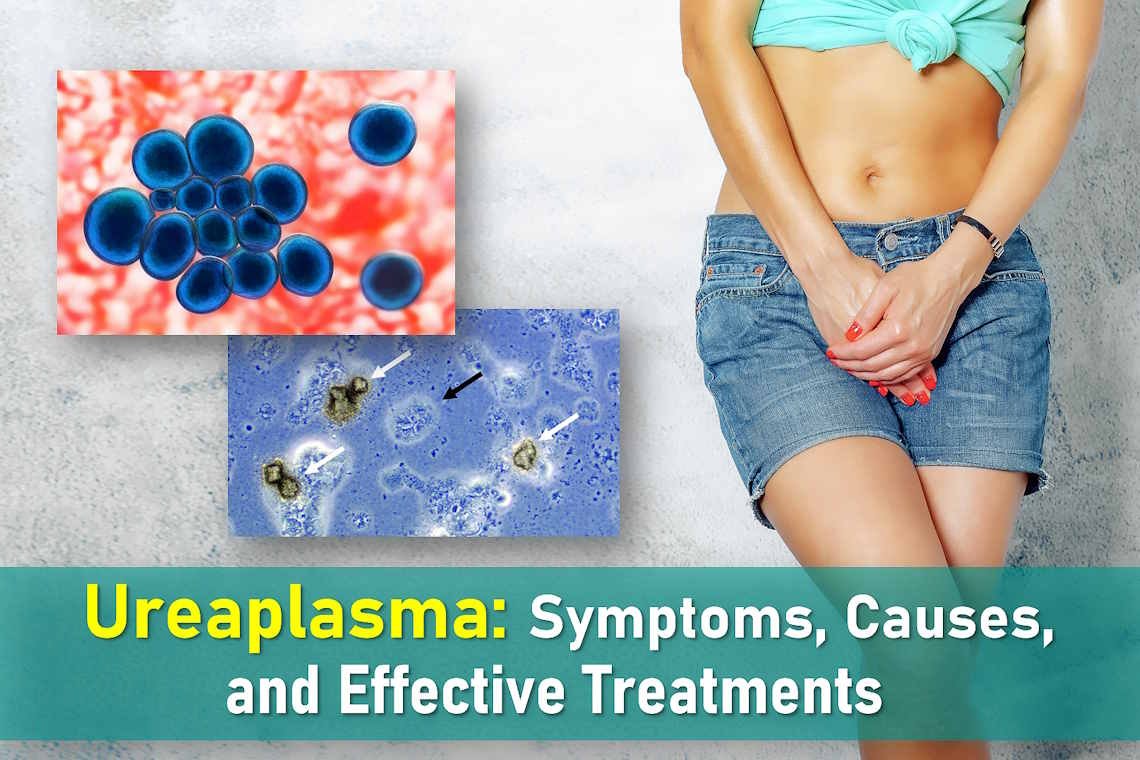 ureaplasma, ureaplasma symptoms, symptoms of ureaplasma in females, ureaplasma infection, ureaplasma treatment