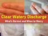 watery discharge, clear discharge, watery discharge feels like I peed myself, watery discharge after intercourse