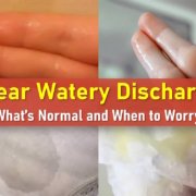 watery discharge, clear discharge, watery discharge feels like I peed myself, watery discharge after intercourse watery discharge, clear discharge, watery discharge feels like I peed myself, watery discharge after intercourse