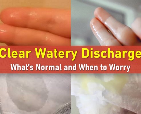 watery discharge, clear discharge, watery discharge feels like I peed myself, watery discharge after intercourse