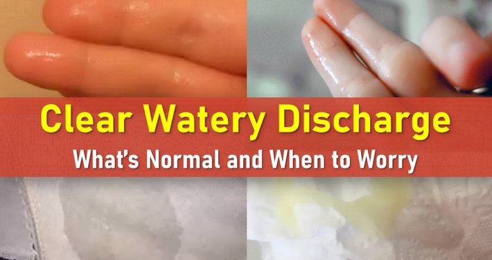 watery discharge, clear discharge, watery discharge feels like I peed myself, watery discharge after intercourse