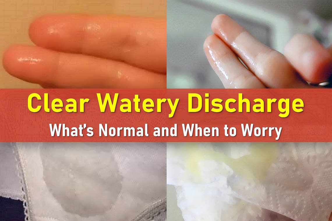 watery discharge, clear discharge, watery discharge feels like I peed myself, watery discharge after intercourse